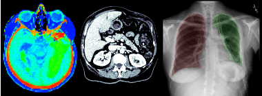 Анализ медицинских изображений в Python