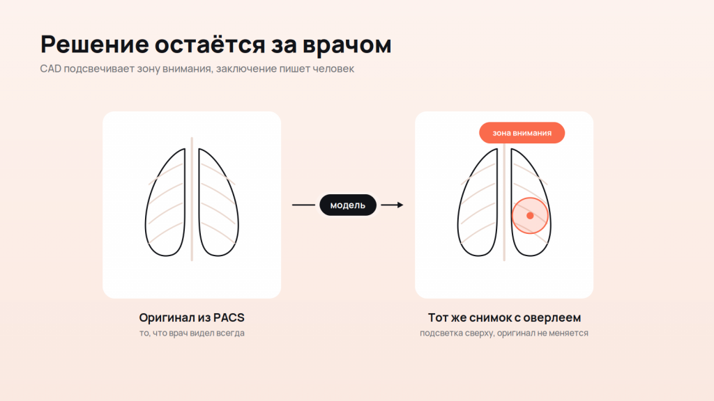 Интеграция модели в PACS
