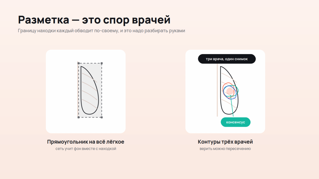 Разметка медицинских изображений
